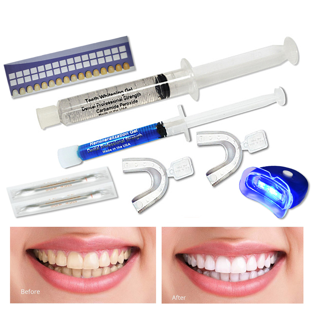 Always White Premium Home Teeth Whitening System Kit ...